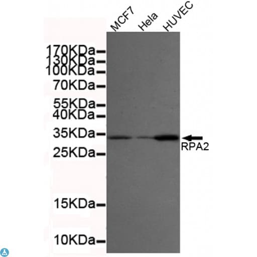 RPA2 / RFA2 / RPA34 Antibody