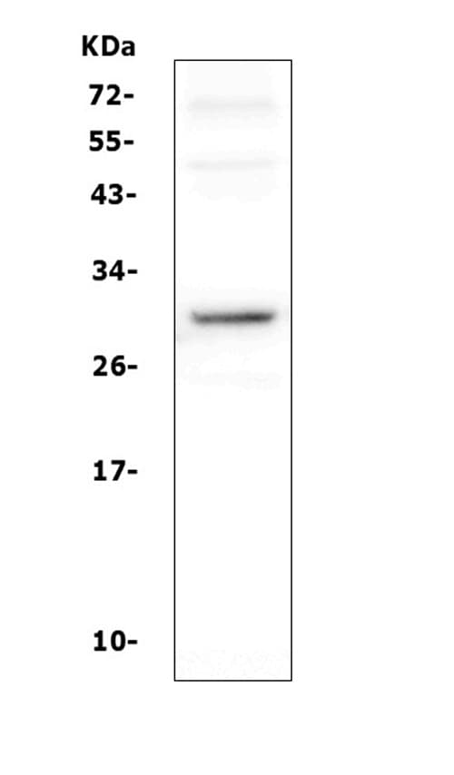 DCK / Deoxycytidine kinase Antibody