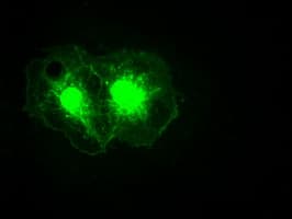 NOG / Noggin Antibody (clone OTI1C1)