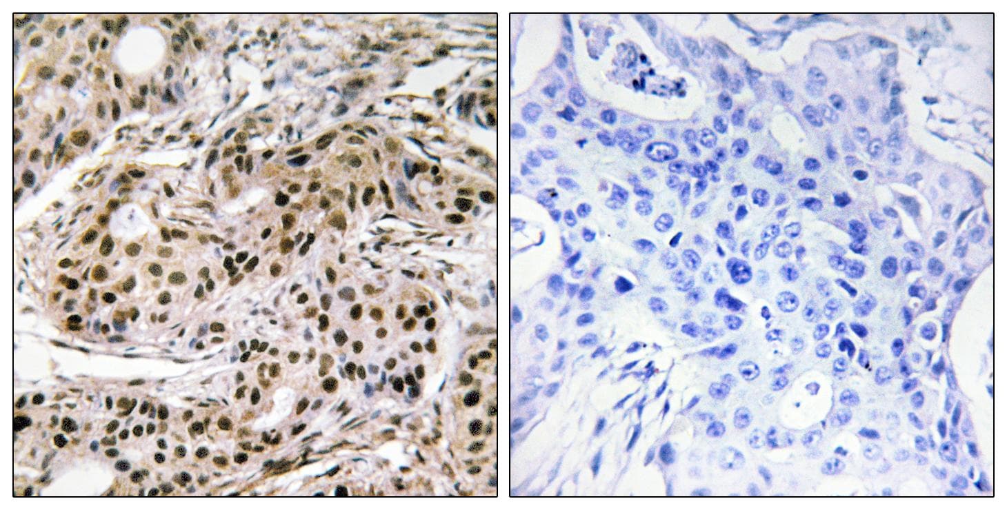Polyclonal Rabbit anti-Human PDCD4 Antibody (phospho-Ser457, IHC, WB)