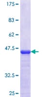 Human RNF128 / GRAIL Protein (Recombinant GST, N-terminus)
