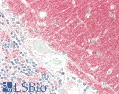 IHC-plus™ RAB3A Antibody (clone 1531CT562.14.57)