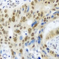 PSMA4 Antibody