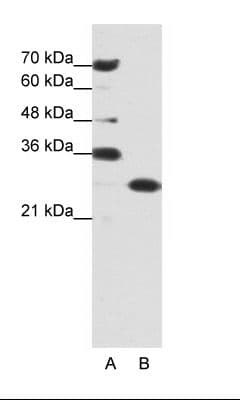 PHAP1 / ANP32A Antibody (aa121-170)