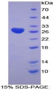 Human LOXL3 Protein (Recombinant His-T7)