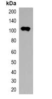 Thioredoxin / TRX Tag Antibody