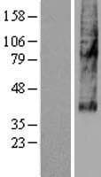 SLC46A3 Protein (Over-Expression Lysate Myc-DDK (Flag))