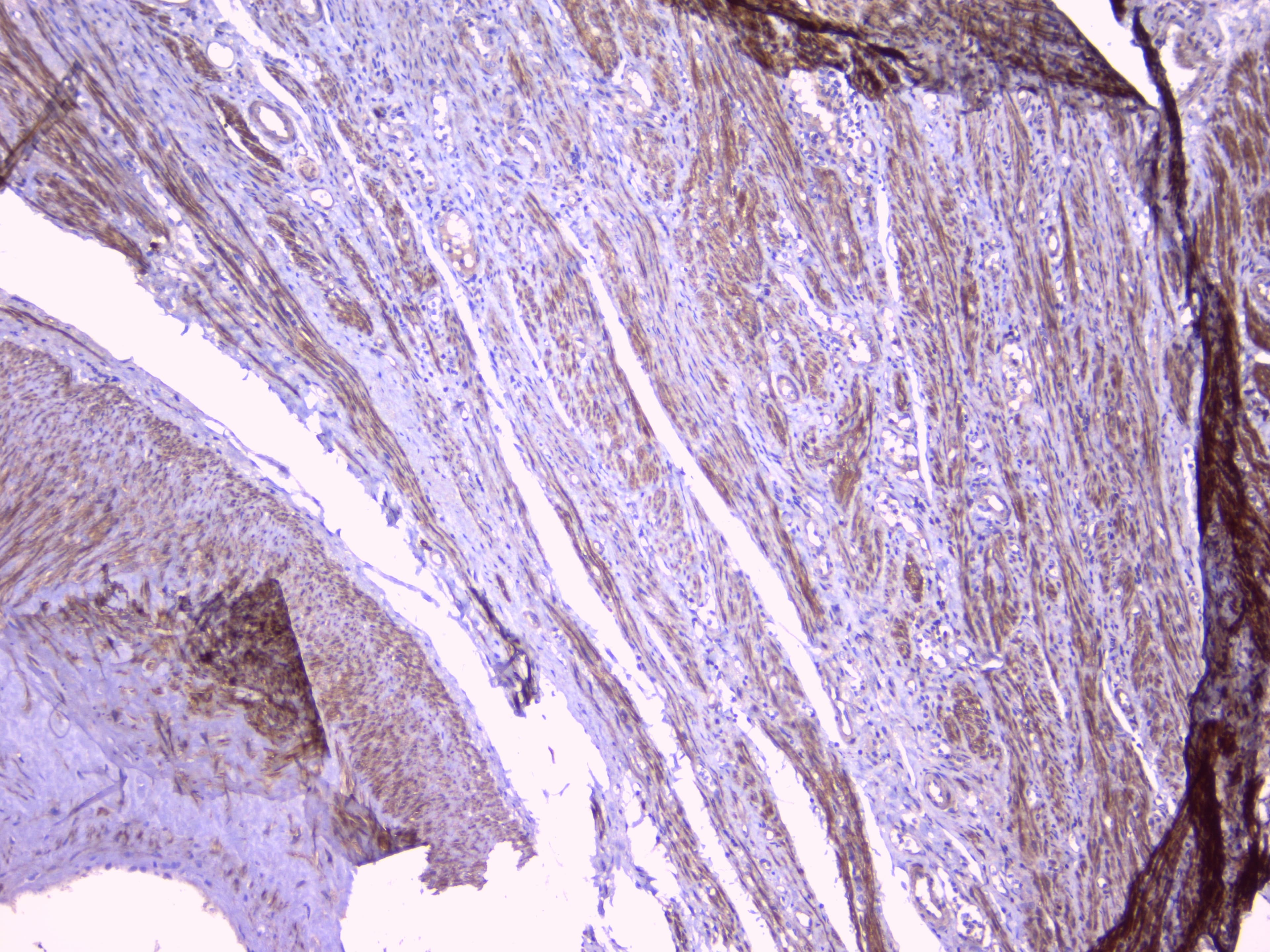 Polyclonal Rabbit anti-Human PEBP1 / RKIP Antibody (WB)
