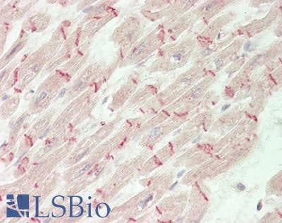 IHC-plus™ MSTN / GDF8 / Myostatin Antibody (aa 267-375)