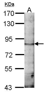 EML1 / EMAP Antibody (aa753-815)