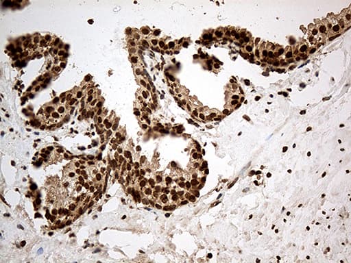 CDK15 / ALS2CR7 Antibody (aa293-378, clone OTI3B9)
