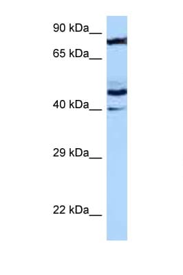 Polyclonal Rabbit anti-Human MRPS31 Antibody (aa34-83, WB)