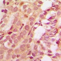 MCL1 / MCL 1 Antibody (Internal)
