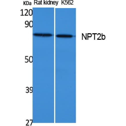 Polyclonal Rabbit anti-Human SLC34A2 / NaPi-2b Antibody (630-710 aa, C-terminal, WB)