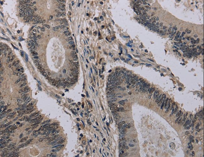 HIST1H2AH Antibody