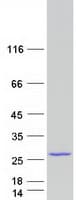 Human UBCH / UBE2H Protein (Recombinant Myc-DDK (Flag))