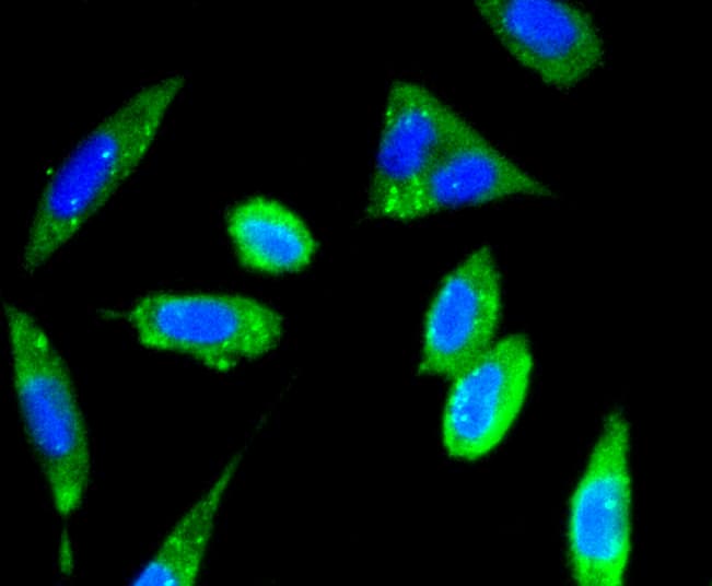Monoclonal Rabbit anti-Human FAK / Focal Adhesion Kinase Antibody (IF, WB)