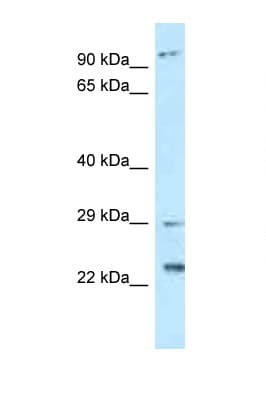C17orf70 Antibody (aa92-141)
