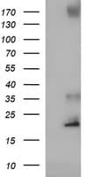 Monoclonal Mouse anti-Human C17orf62 Antibody (clone OTI3B5, WB)