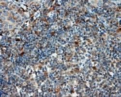 LIPG / Endothelial Lipase Antibody (clone OTI9F2, Carrier-free)