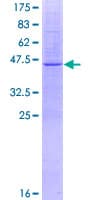 Human TMEM41B Protein (Recombinant GST)