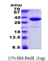 Human SMUG1 Protein (Recombinant His)