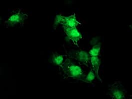 AKT1 Antibody (clone OTI2B9)