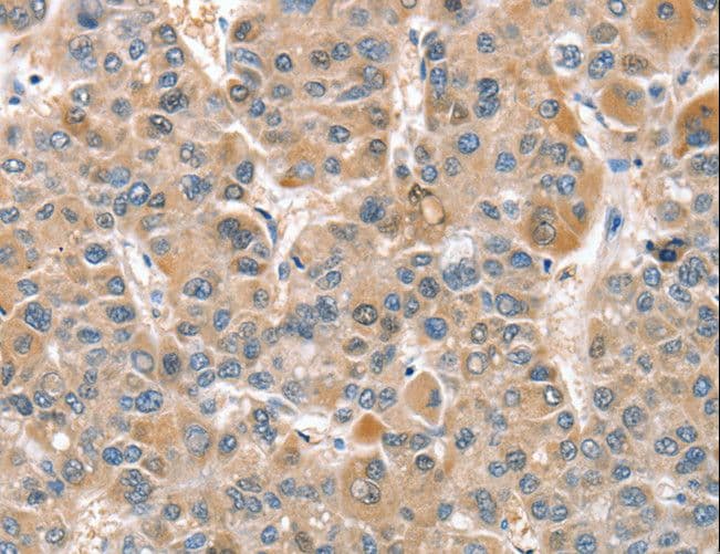 CIAPIN1 / Anamorsin Antibody