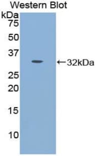 CDH16 / Cadherin 16 Antibody (aa353-617, HRP)