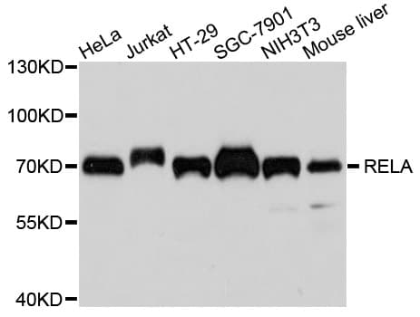 RELA / NFKB p65 Antibody