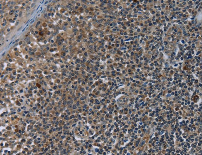 GYPC / Glycophorin C Antibody