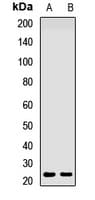 Polyclonal Rabbit anti-Human DHAND / HAND2 Antibody (IF, WB)