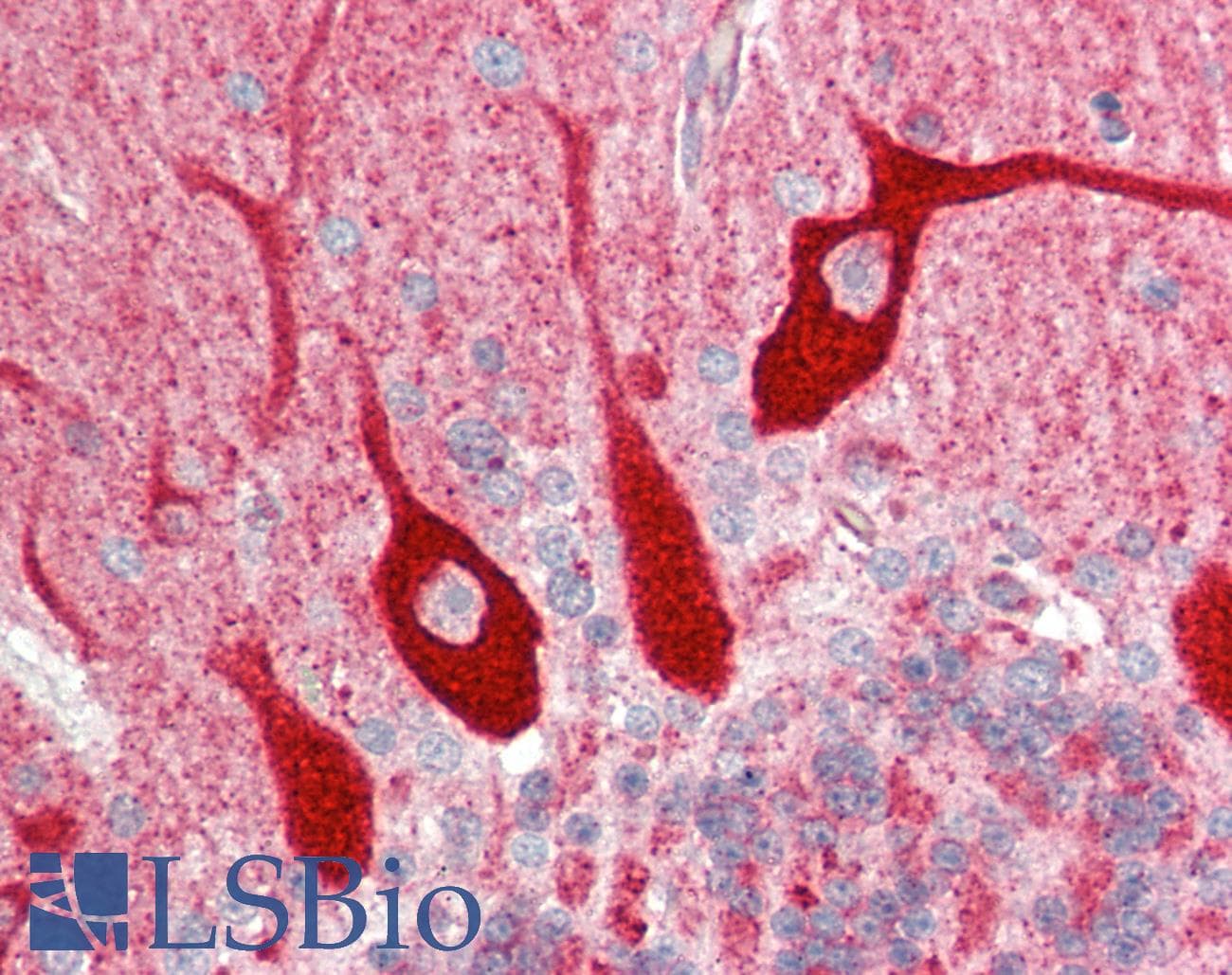 EEF1A2 Antibody (aa360-409)