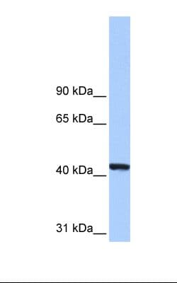 PGK1 / Phosphoglycerate Kinase Antibody (aa102-151)