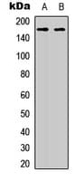 TBC1D4 / AS160 Antibody (Internal)