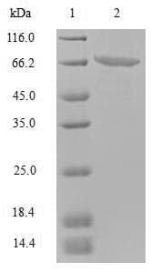 Norovirus Capsid Protein VP1 (Recombinant Myc-DDK (Flag), C-terminus)