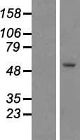 KATNAL1 Protein (Over-Expression Lysate Myc-DDK (Flag))
