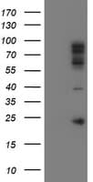Paraplegin / SPG7 Antibody (aa300-573, clone OTI2B9)