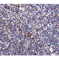 S1PR1 / EDG1 / S1P1 Antibody