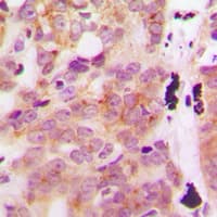 GLB1L3 Antibody (Internal)