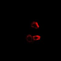 PathPlus™ GPBB / PYGB Antibody