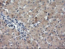 EEYORE / TIGD1 Antibody (aa1-267, clone OTI4G9)