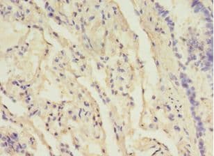 B3GNT5 Antibody (Biotin)