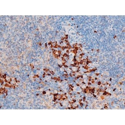 Polyclonal Rabbit anti-Human SYK Antibody (phospho-Tyr348, IHC, IF, WB)