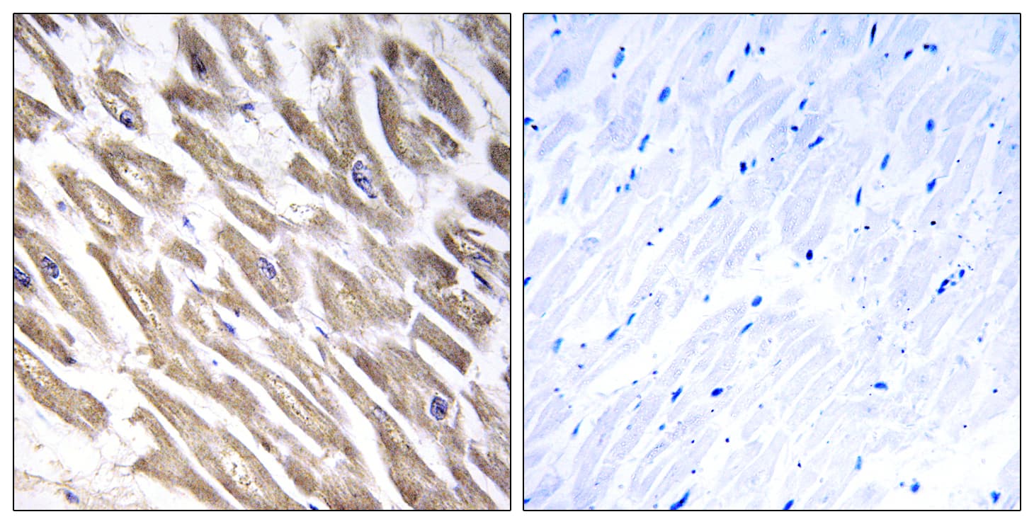 F13B / TGase Antibody