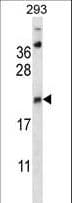 AES / Groucho Antibody (aa156-184)