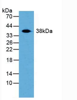Transaldolase Antibody (aa35-285, Cy3)