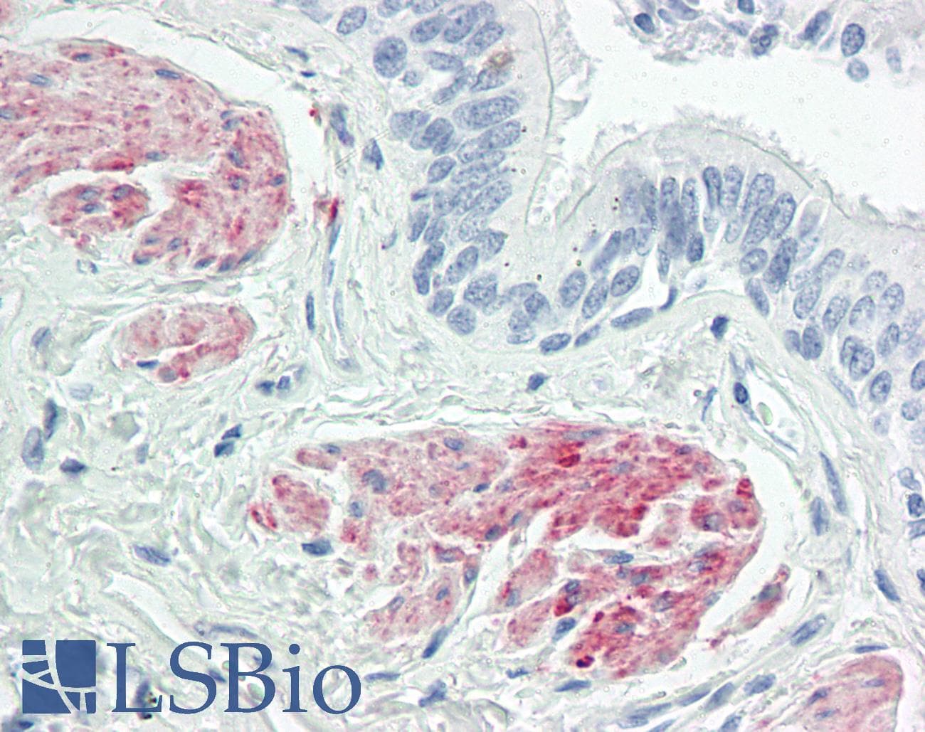 IHC-plus™ Polyclonal Rabbit anti-Human ZC3H8 Antibody (aa81-130, IHC, WB)