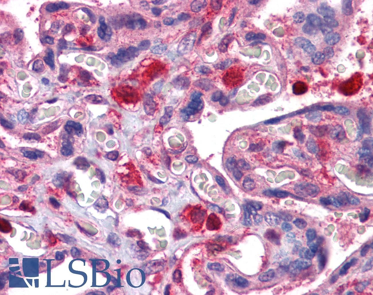 IHC-plus™ GDI2 Antibody