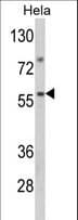 SARS2 / SYS Antibody (aa315-344)